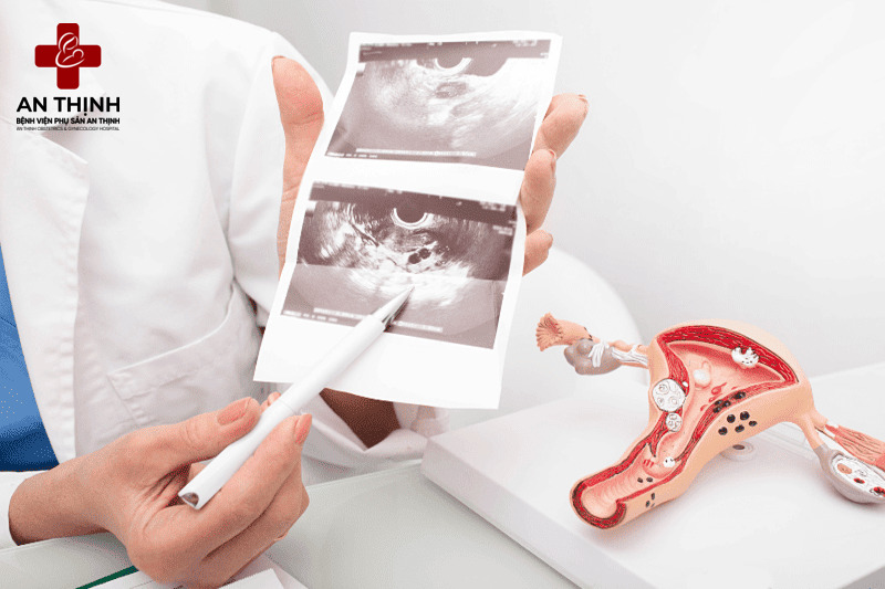 Chi phí khám phụ khoa bao nhiêu tiền?