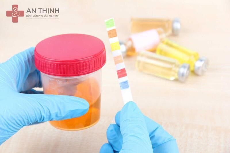 Xét nghiệm nước tiểu giúp phát hiện sớm bệnh lý tiết niệu và thận