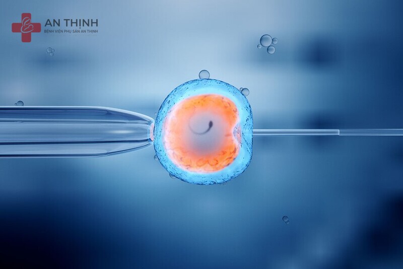 Thụ tinh trong ống nghiệm IVF là gì?