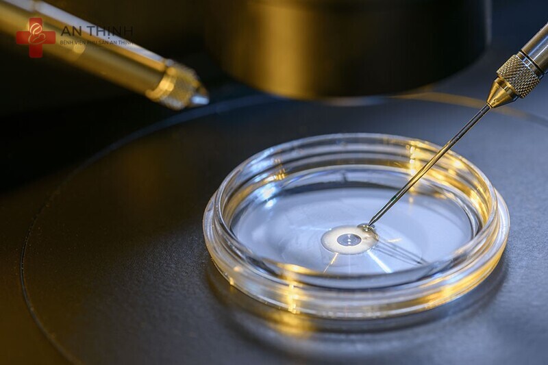 Kỹ thuật thực hiện và quy trình trong phòng lab