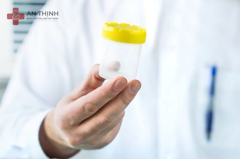 Nguyên nhân vô sinh từ người chồng