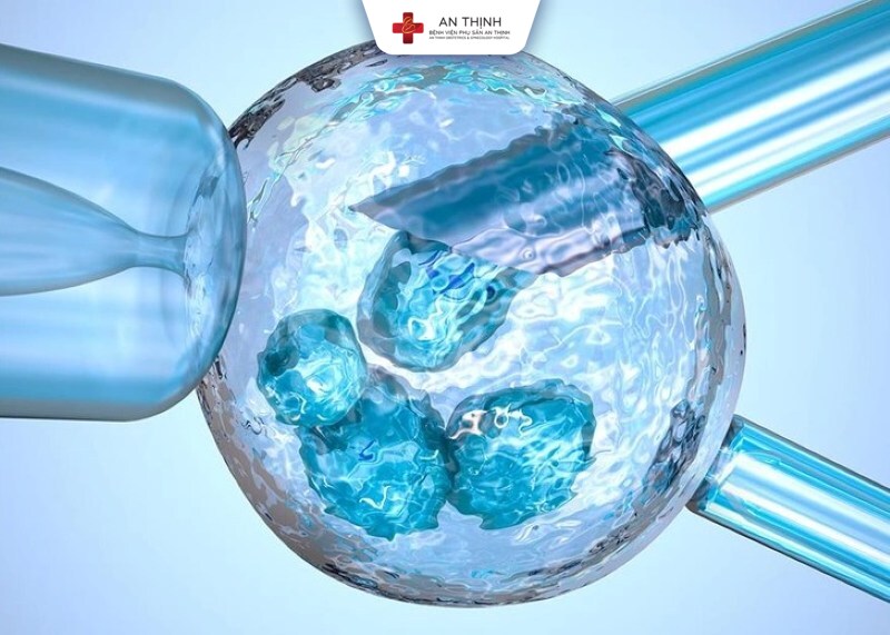 Xét nghiệm PGT trong IVF: Sinh thiết có làm hỏng phôi hay không? 